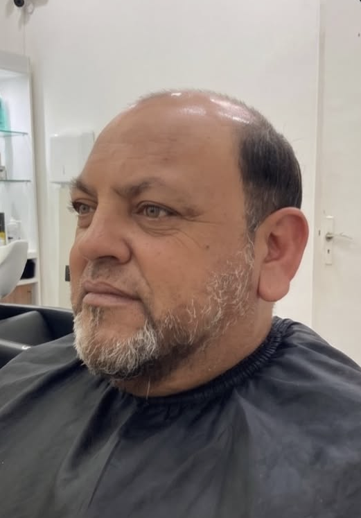 Marcelo antes del sistema capilar